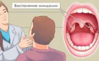 Ребенок не дышит носом, но соплей нет — что делать, как лечить