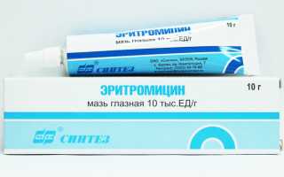 Лечебные свойства эритромициновой глазной мази: для чего назначают и как применять