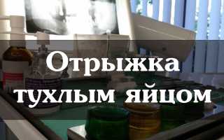 Что делать при отрыжке тухлыми яйцами?