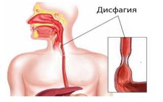 Возможные причины боли в пищеводе