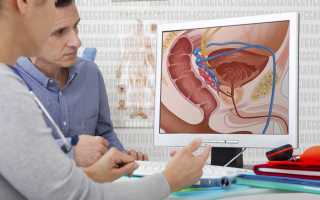 Диагностика аденомы простаты у мужчин: все современные методы