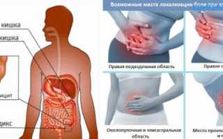 Характерные симптомы при аппендиците у взрослых