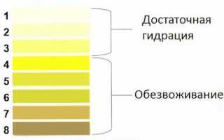 Почему анализы мочи плохие: основные показатели и отклонения от нормы