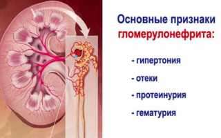 Механизм развития постстрептококкового гломерулонефрита, симптомы и лечение