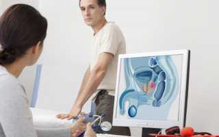 Массаж предстательной железы: техника выполнения, лечебный эффект